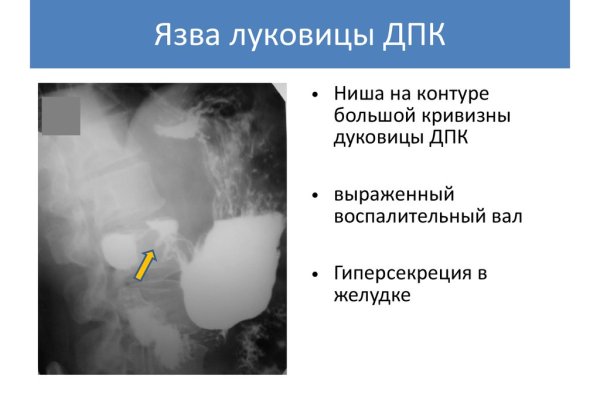 Рабочая ссылка кракен в тор